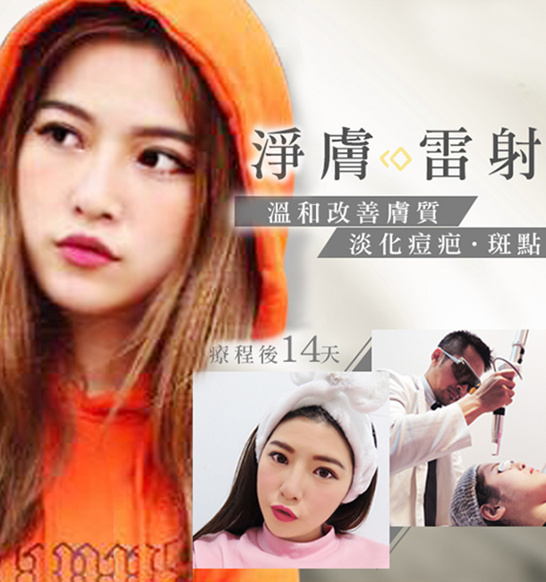 臻品絕色,光繞雷射